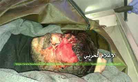 el terrorista Abu Abdo muerto